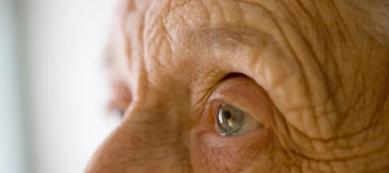 vieillisement peau personnes agees