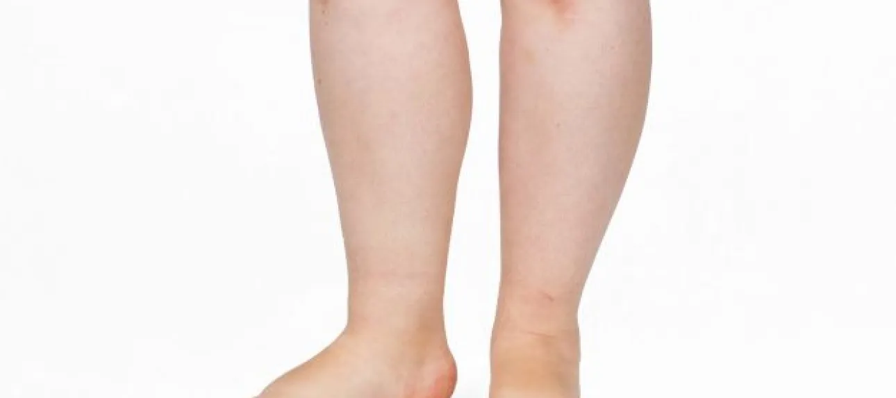 remede de grand mere pour les pieds gonfles