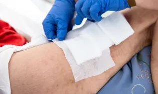 comment soigner un escarre