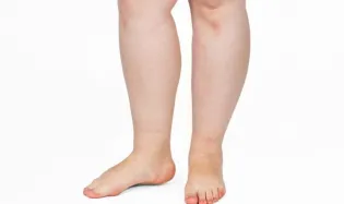 remede de grand mere pour les pieds gonfles