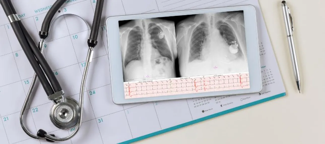 interdiction avec un pacemaker