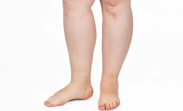 remede de grand mere pour les pieds gonfles