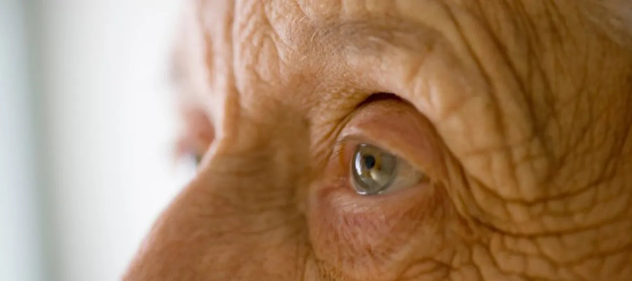 vieillisement peau personnes agees
